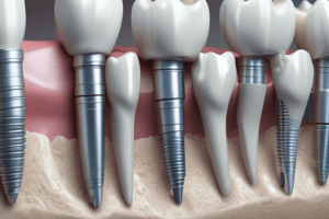 Dental Implant-Abutment Connection