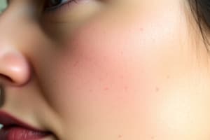 Dermatology Quiz: Hyperpigmentation and Melasma