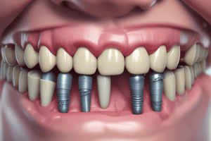 Dental Implant Complications