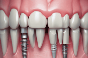 PROSTHETIC OPTIONS IN IMPLANT