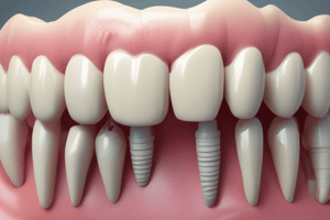 Effets du joint élastique en dentisterie