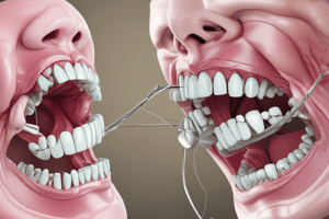 Mental Dental Perio Video 11 Flap