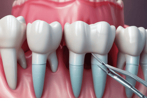 Cimentação Definitiva em Odontologia