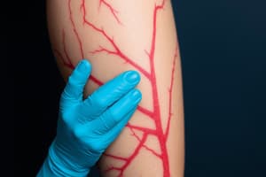 Syncope and Varicose Veins Quiz