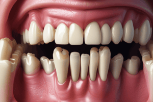 Periodontal Disease: Immunopathogenesis