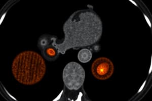 Liver CT Scan: Hepatocellular Carcinoma vs Hemangioma