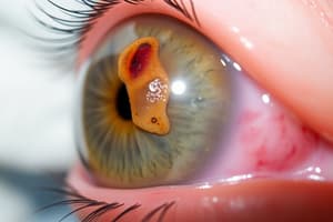 Úlceras de Córnea e Edema Corneal