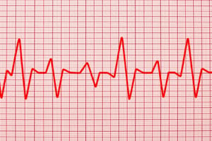 Abnormal Sinus Rhythms and Tachycardia