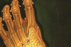 Gout and Crystal-Associated Arthritis