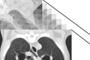 4 -  Principles of Computed Tomography and Magnetic Resonance Imaging