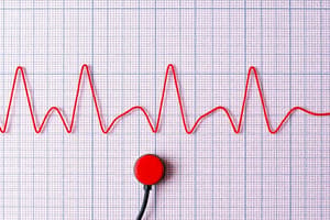 Cardiac Conduction and EKG Basics