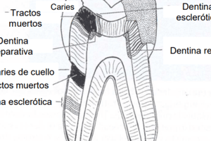 Tema 31