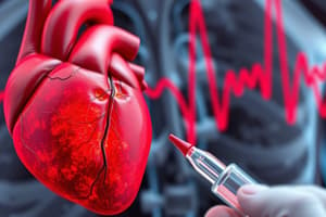 Infarto del miocardio con elevación del segmento ST