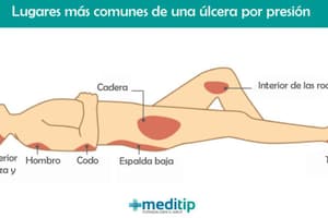 Prevencion ulceras por presion