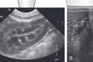 Diagnostic Ultrasound Physics