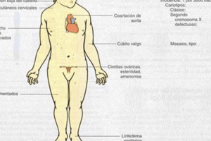 137. Quiz Trisomías I 289 a 293