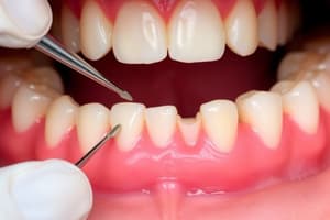 Periodontal Assessment Quiz