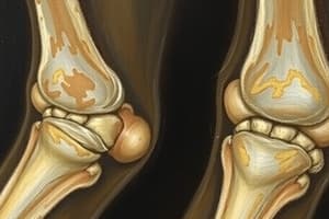 Osteoporosis, Osteoarthritis, Rheumatoid Arthritis, Gout, Fractures