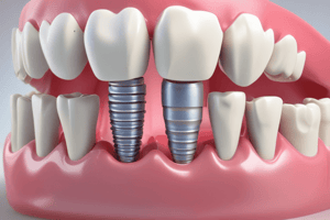 Dentistry: Implant Supported Overdentures