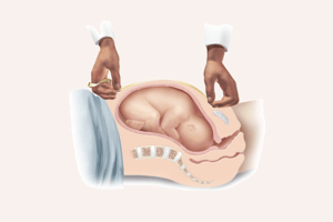 Chapter 7: Antepartum Assessment, Care, and and Education