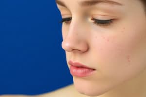 Acne Vulgaris and Atopic Dermatitis