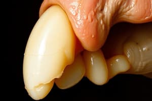 Ameloblastic Fibroma Overview