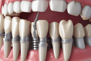 Dental Implant Prosthetics