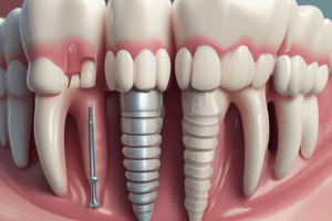 Periodontal Disease