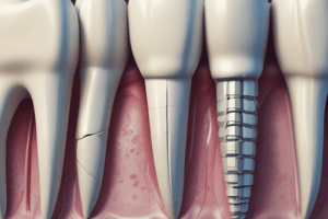 Dental Treatment of Tooth Fractures