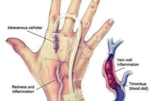 Prevención de las complicaciones del acceso vascular de inserción periférica: programa Flebitis