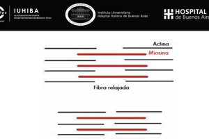 33. Quiz Prevención I 93 a 103