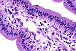 Gastrointestinal Disorders: Pathophysiology and Etiology