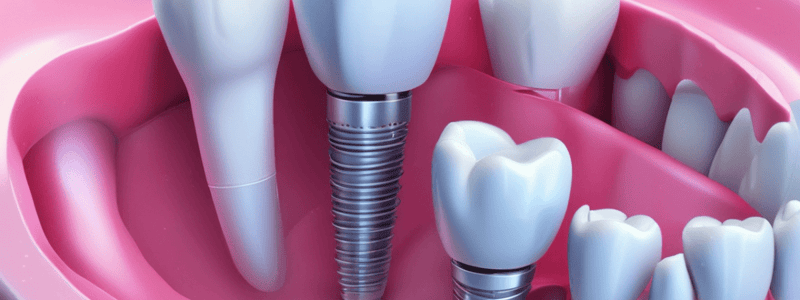 Dental Implants Indications Quiz