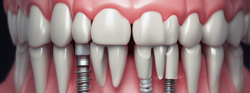 PROSTHETIC OPTIONS IN IMPLANT