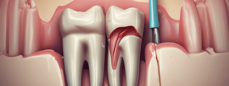 Root Canal Treatment: Cleaning and Shaping