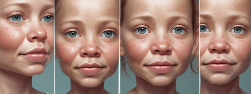 Cleft Lip and Palate: Craniofacial Malformation