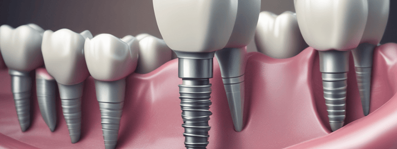 Dental Implants Chapter 1