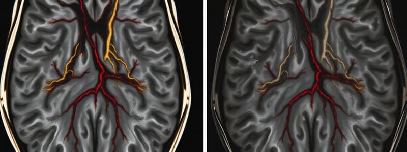 Medullary Osteonecrosis Quiz