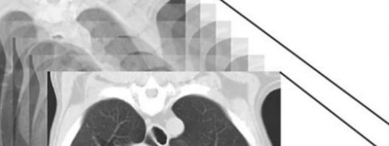 4 -  Principles of Computed Tomography and Magnetic Resonance Imaging