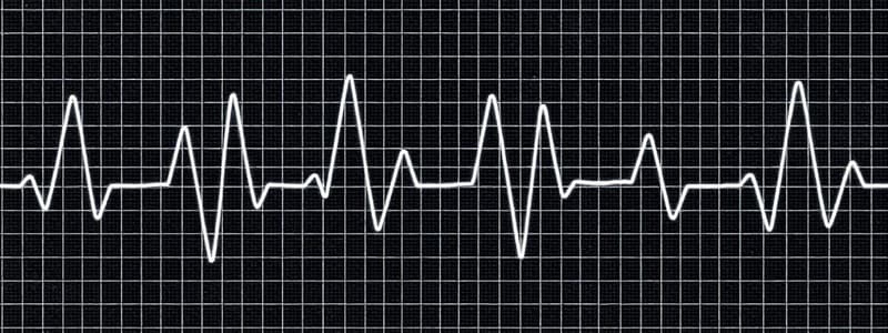 Electrocardiograma (ECG) - Derivaciones