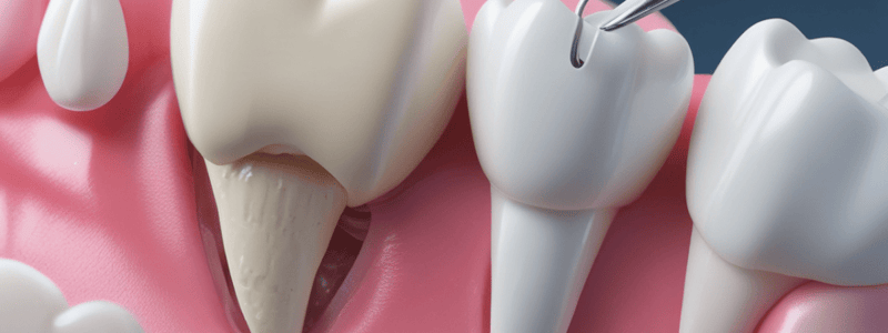 Sturdevant 6th Edition Chapter 5 Tooth Preparation Quiz