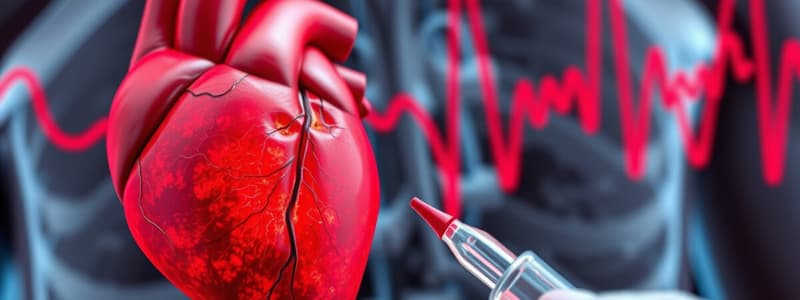 Infarto del miocardio con elevación del segmento ST