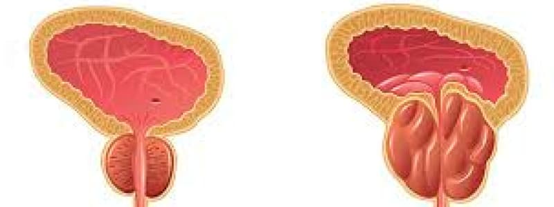 212B Male Reproductive BPH Overview