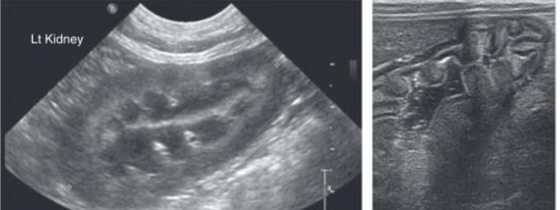 Diagnostic Ultrasound Physics