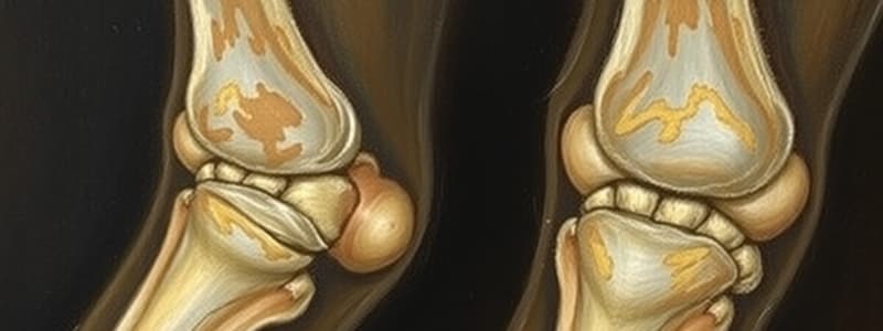 Osteoporosis, Osteoarthritis, Rheumatoid Arthritis, Gout, Fractures