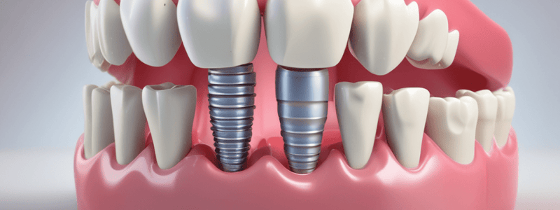 Dentistry: Implant Supported Overdentures