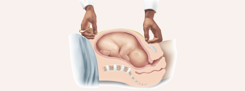 Chapter 7: Antepartum Assessment, Care, and and Education