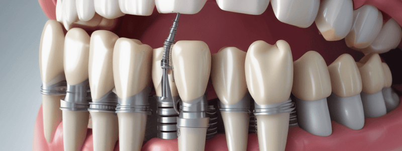 Dental Implant Prosthetics