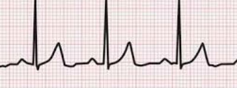 lab 6 - ECG