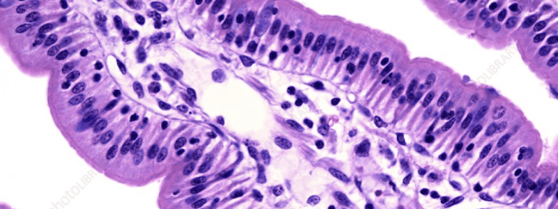 Gastrointestinal Disorders: Pathophysiology and Etiology